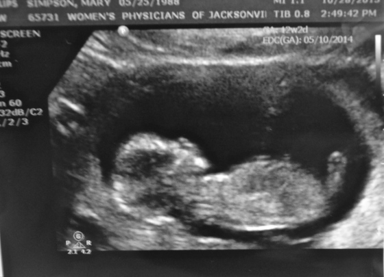 Baby SImpson at 12 weeks