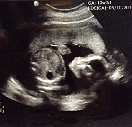 19 weeks baby ultrasound